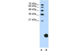 WB Suggested Anti-RPS29 Antibody Titration:  1. (RPS29 抗体  (N-Term))