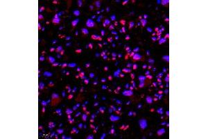 Immunofluorescence of paraffin embedded mouse placenta using SMNDC1 (ABIN7075773) at dilution of 1:650 (400x lens) (SMNDC1 抗体)