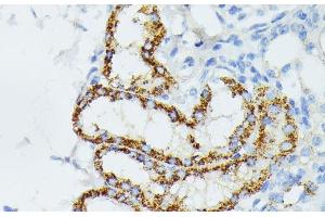 Immunohistochemistry (Paraffin-embedded Sections) (IHC (p)) image for anti-Ethylmalonic Encephalopathy 1 (ETHE1) antibody (ABIN7255167)