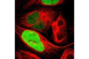 Immunofluorescent staining of U-2 OS with TPX2 polyclonal antibody  (Green) shows positivity in nucleus but excluded from the nucleoli. (TPX2 抗体)