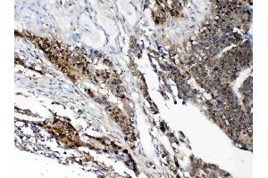 IHC analysis of STAT1 using anti- STAT1 antibody .