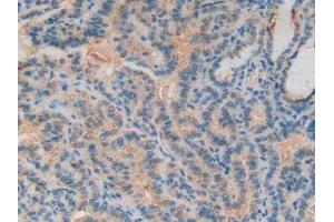 Immunohistochemistry (IHC) image for anti-Complement Component 3 (C3) (AA 1000-1326) antibody (ABIN7432772)