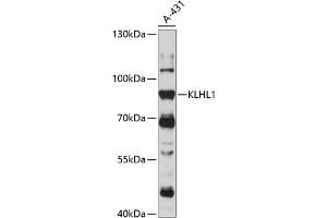 Western blot analysis of extracts of A-431 cells, using KLHL1 antibody (ABIN7268077) at 1:1000 dilution. (KLHL1 抗体  (AA 1-210))