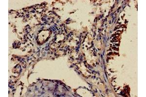 Immunohistochemistry of paraffin-embedded human lung tissue using ABIN7158098 at dilution of 1:100 (SHoc2/Sur8 抗体  (AA 3-89))