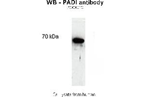 Image no. 1 for anti-Peptidyl Arginine Deiminase, Type II (PADI2) antibody (ABIN346986)