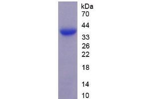 Image no. 1 for Microfibrillar Associated Protein 2 (MFAP2) (AA 6-162) (Active) protein (His tag) (ABIN6239901)