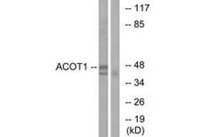 Western blot analysis of extracts from Jurkat cells, using ACOT1 Antibody. (ACOT1 抗体  (AA 91-140))