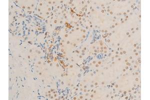 ABIN6267271 at 1/100 staining rat kidney tissue sections by IHC-P. (c-MYC 抗体  (pSer62))