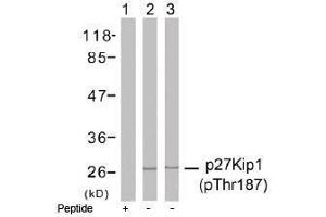 Image no. 1 for anti-Cyclin-Dependent Kinase Inhibitor 1B (p27, Kip1) (CDKN1B) (pThr187) antibody (ABIN196947)