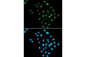 Immunofluorescence analysis of MCF-7 cells using EIF6 antibody. (EIF6 抗体)