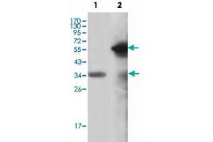 Western blot analysis using MLL monoclonal antibody, clone 10F8D7  against truncated MLL recombinant protein (1) and truncated GFP-MLL(aa 3714-3969) transfected COS-7 cell lysate (2).