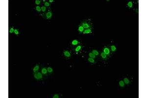 Immunofluorescence staining of Hela cells with ABIN7139609 at 1:5, counter-stained with DAPI. (HIST1H2AG 抗体  (meLys9))