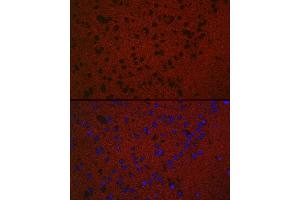 Immunofluorescence analysis of Mouse brain using RA antibody (ABIN7269809) at dilution of 1:50. (RAB3A 抗体  (AA 100-200))