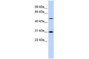 WB Suggested Anti-ING3 Antibody Titration:  0. (ING3 抗体  (N-Term))