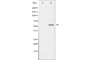 Western blot analysis of MEF2A phosphorylation expression in UV treated K562 whole cell lysates,The lane on the left is treated with the antigen-specific peptide. (MEF2A 抗体  (pThr319))