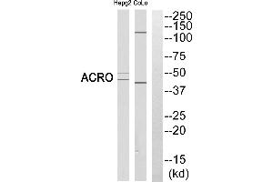 Western blot analysis of extracts from HEPG2 cells and COLO cells, using ACRO (heavy chain, Cleaved-Ilantibody. (Acrosin 抗体  (Cleaved-Ile43, Heavy Chain))