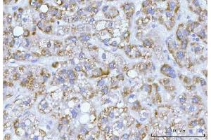 IHC analysis of Hamartin/TSC1 using anti-Hamartin/TSC1 antibody (ABIN7599499). (TSC1 抗体  (AA 1-618))