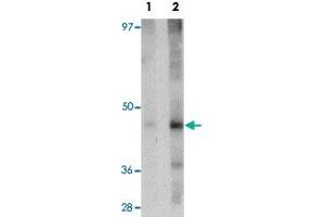 Western blot analysis of rat liver tissue with NR1H3 polyclonal antibody  at (Lane 1) 1 and (Lane 2) 2 ug/mL dilution. (NR1H3 抗体  (N-Term))