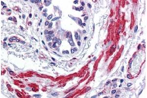 Human Lung, bronchial smooth muscle: Formalin-Fixed, Paraffin-Embedded (FFPE) (Actin 抗体  (AA 1-129))