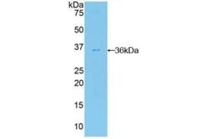 Detection of Recombinant FDFT1, Human using Polyclonal Antibody to Farnesyl Diphosphate Farnesyltransferase 1 (FDFT1) (FDFT1 抗体  (AA 269-417))
