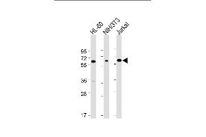 All lanes : Anti-ME2 Antibody (C-term) at 1:4000 dilution Lane 1: HL-60 whole cell lysate Lane 2: NIH/3T3 whole cell lysate Lane 3: Jurkat whole cell lysate Lysates/proteins at 20 μg per lane. (NAD-ME 抗体  (C-Term))