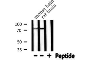 Western blot analysis of PRKCG expression in various lysates (PKC gamma 抗体  (Internal Region))
