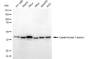 Western blotting analysis using casein kinase 1 epsilon antibody (ABIN7797881). (CK1 epsilon 抗体)