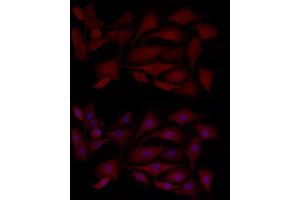 Immunofluorescence analysis of NIH/3T3 cells using MCL1 Rabbit pAb (ABIN3020787, ABIN3020788, ABIN3020789 and ABIN6213724) at dilution of 1:100 (40x lens). (MCL-1 抗体  (AA 120-220))