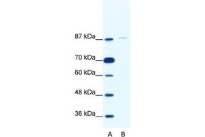 Western Blotting (WB) image for anti-TATA Box Binding Protein (TBP)-Associated Factor, RNA Polymerase I, C, 110kDa (TAF1C) antibody (ABIN2461762) (TAF1C 抗体)