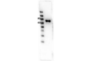 Western Blot of Rabbit anti-RON antibody. (MST1R 抗体  (Internal Region, Tyr1353))
