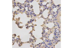Immunohistochemistry of paraffin-embedded mouse lung using PRKACB antibody.