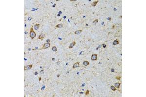 Immunohistochemistry of paraffin-embedded mouse brain using CDK1 antibody. (CDK1 抗体)