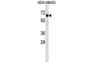 STEAP3 Antibody (C-term) western blot analysis in MDA-MB453 cell line lysates (35µg/lane). (STEAP3 抗体  (C-Term))