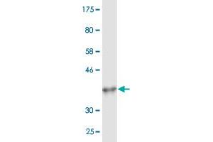 Western Blotting (WB) image for anti-Cytochrome P450, Family 26, Subfamily B, Polypeptide 1 (CYP26B1) (AA 131-230) antibody (ABIN527926)