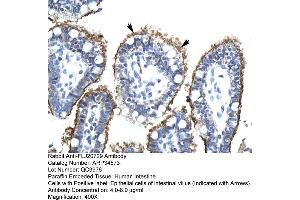 Human Intestine (FLJ20729 (C-Term) 抗体)