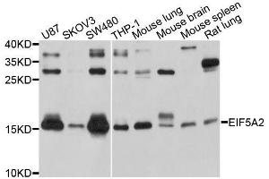 Western blot analysis of extracts of various cell lines, using EIF5A2 antibody. (EIF5A2 抗体  (AA 1-153))