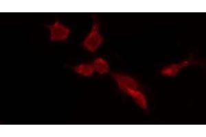 ABIN6275659 staining HepG2 by IF/ICC. (USP45 抗体  (Internal Region))