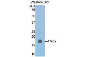 Western Blotting (WB) image for anti-Janus Kinase 2 (JAK2) (AA 689-807) antibody (ABIN3203630) (JAK2 抗体  (AA 689-807))