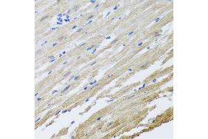 Immunohistochemistry of paraffin-embedded rat heart using SET antibody at dilution of 1:100 (x40 lens). (SET/TAF-I 抗体)