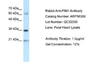 WB Suggested Anti-PIM1 Antibody Titration: 0. (PIM1 抗体  (N-Term))