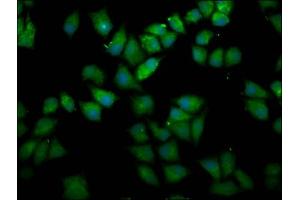 Immunofluorescence staining of Hela cells with ABIN7167644 at 1:166, counter-stained with DAPI. (UPF3B 抗体  (AA 319-423))