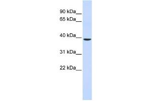 WB Suggested Anti-C2orf60 Antibody Titration:  0. (C2orf60 抗体  (Middle Region))