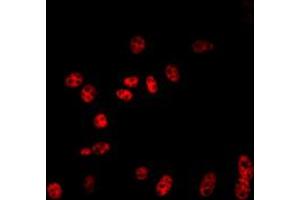 Immunofluorescent analysis of Cullin 2 staining in NIH3T3 cells. (Cullin 2 抗体  (C-Term))