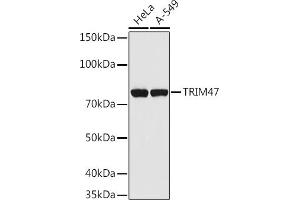 Western blot analysis of extracts of various cell lines, using TRIM47 antibody (ABIN7270991) at 1:1000 dilution. (TRIM47 抗体  (AA 356-530))