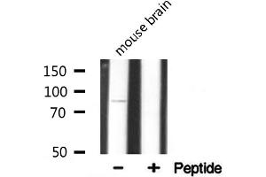 Western blot analysis on mouse brain lysate using Integrin beta-5 Antibody. (Integrin beta 5 抗体  (C-Term))