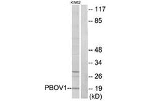 Western Blotting (WB) image for anti-Prostate and Breast Cancer Overexpressed Protein 1 (PBOV1) (AA 31-80) antibody (ABIN2889750) (PBOV1 抗体  (AA 31-80))
