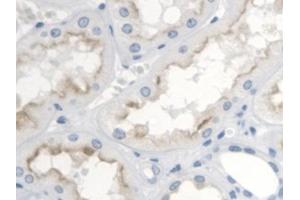 Detection of TP in Human Kidney Tissue using Polyclonal Antibody to Thromboxane Receptor (TP) (TBXA2R 抗体  (AA 3-324))