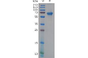 SDS-PAGE (SDS) image for Natural Cytotoxicity Triggering Receptor 1 (NCR1) (AA 22-254) protein (Fc Tag) (ABIN6964172)