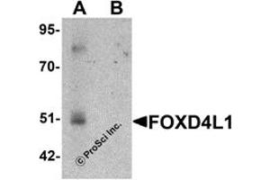 Western Blotting (WB) image for anti-Forkhead Box D4-Like 1 (FOXD4L1) (C-Term) antibody (ABIN1030401) (FOXD4L1 抗体  (C-Term))