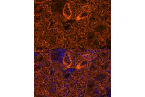 Immunofluorescence (IF) image for anti-Sodium Channel, Nonvoltage-Gated 1, gamma (SCNN1G) (AA 100-250) antibody (ABIN7270387)